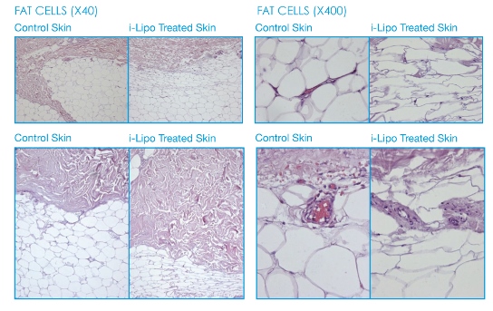 Fat Cells